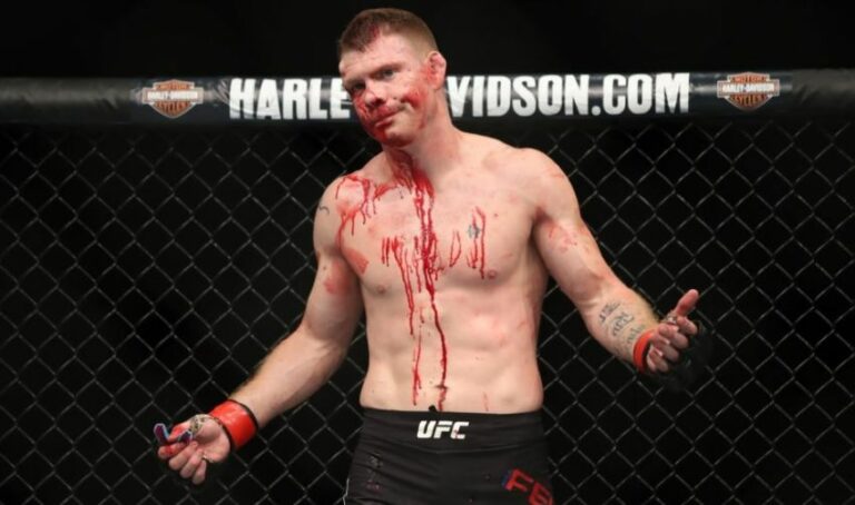Paul Felder showed photos of his injuries, including the removed part of the lung