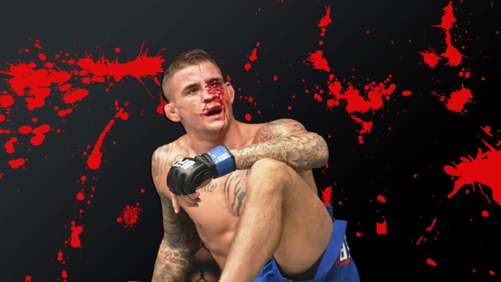 Dustin Poirier named the opponent who managed to injure him the most during the fight