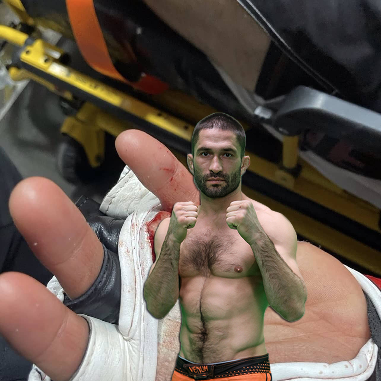 MMA fighter Khetag Pliev from Ossetia fought a whole round with a severed finger. Photo inside