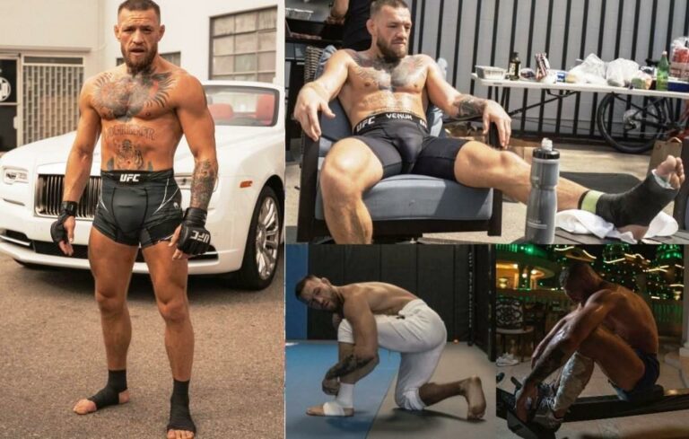 Conor McGregor has published evidence of an injury before the fight with Dustin Poirier at UFC 264