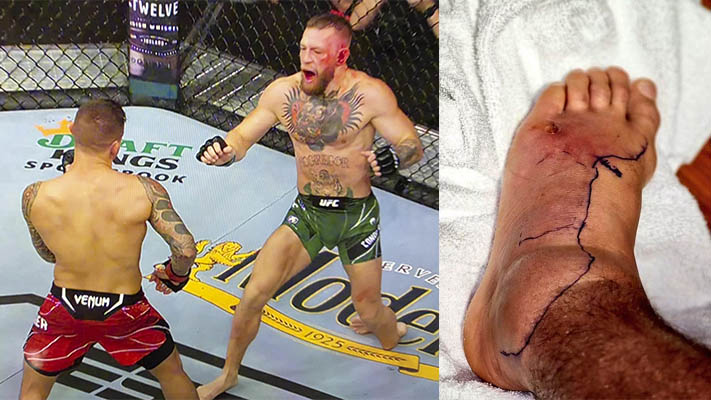 Conor McGregor is sharing his reaction to Dustin Poirier’s recent photos of his foot after a staph infection