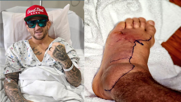 UFC lightweight contender Dustin Poirier undergoes successful surgery on foot after infection causes readmission to hospital