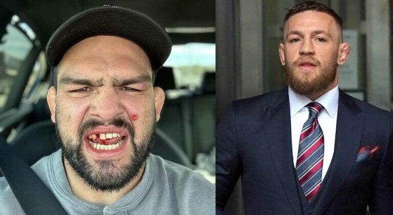 Conor McGregor has expressed concern over Kevin Gastelum’s latest injury, it is more serious than it seems