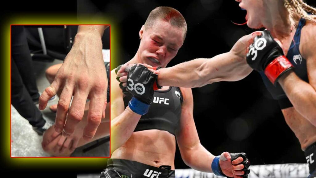 Check out photo - Rose Namajunas shows off grisly hand injury suffered in bloody UFC Paris loss to Manon Fiorot