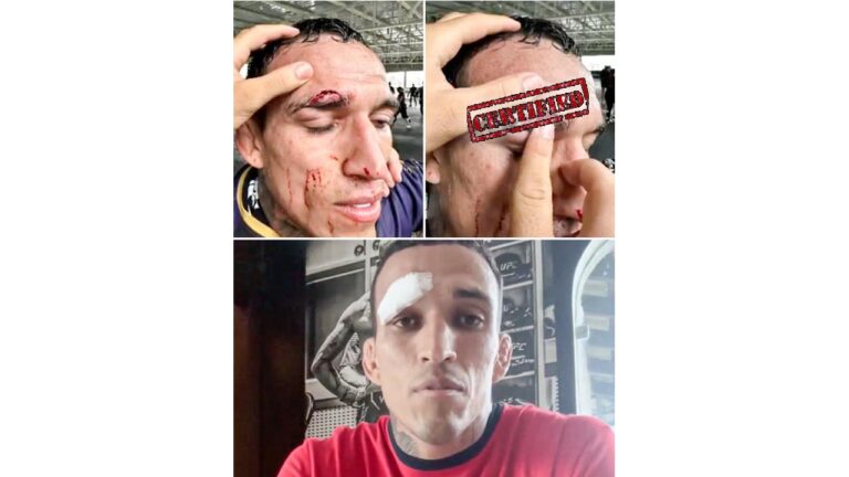 Former Strikeforce champion accuses Charles Oliveira of “stupid” training methods that led to his departure from UFC 294