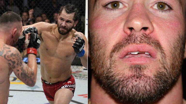 Renowned boxing trainer Teddy Atlas suggests Jorge Masvidal attack could affect Colby Covington at UFC 296