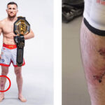 Merab Dvalishvili reports an injury during UFC 311 training camp, and makes a statement about it