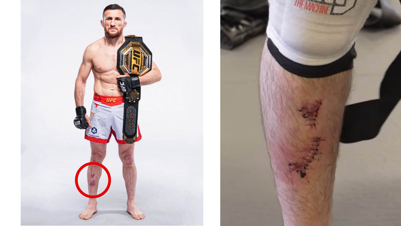 Merab Dvalishvili reports an injury during UFC 311 training camp, and makes a statement about it